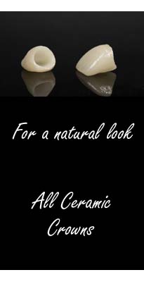 Ceramic Crowns